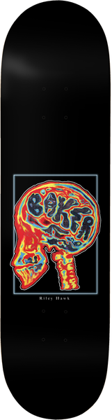 Baker Deck Rh Brain Donor
